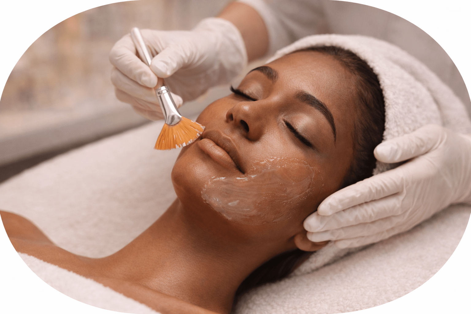Scottsdale chemical peels customized